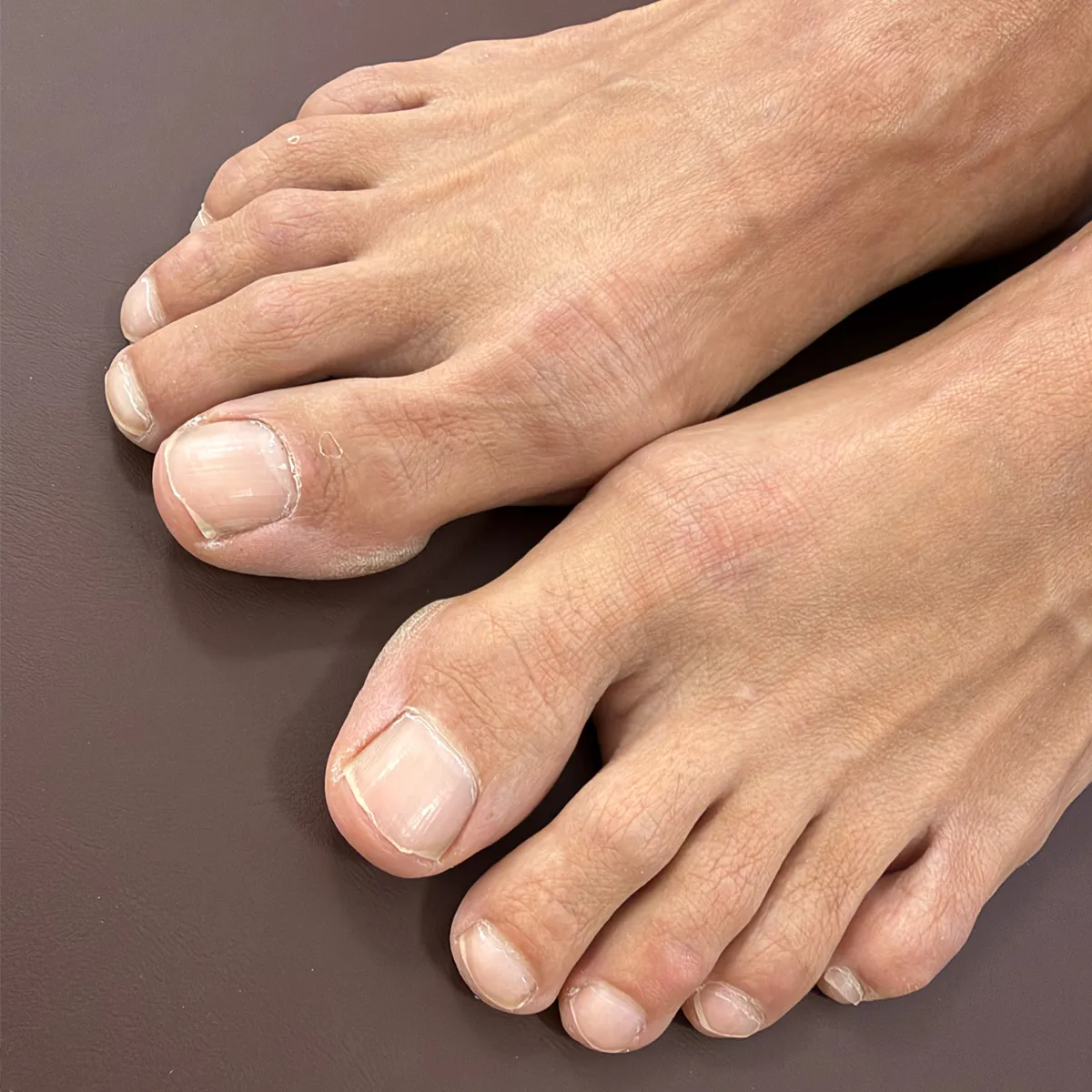 Neat, square-shaped toenails finished in glossy bright pink polish after a pedicurek — before